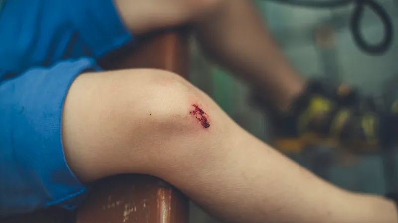 Nahaufnahme eines aufgeschürften Knies eines Kindes in blauer Shorts.